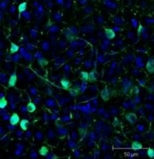 NB100-1771 - GFP
